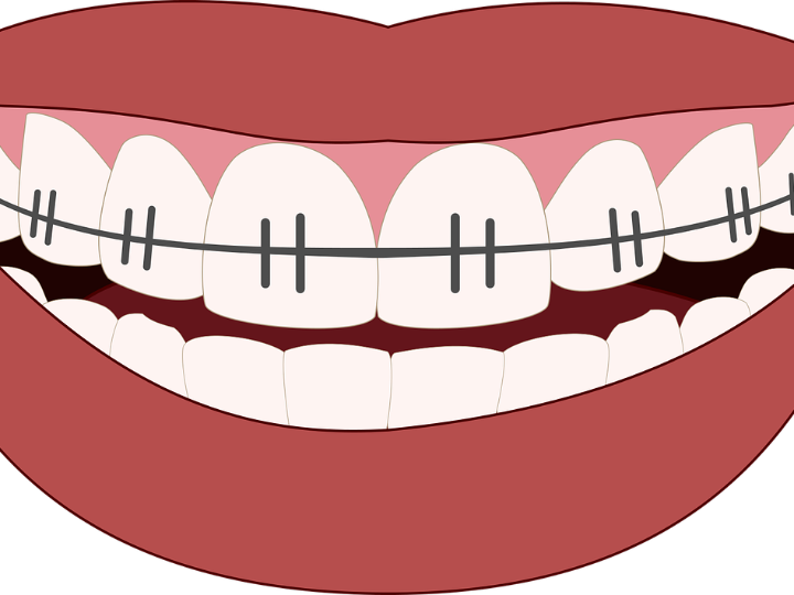 brackets damon acerca de esta ortodoncia
